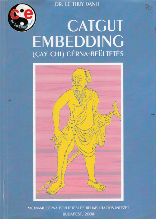 Cérna-beültetés - Catgut embedding