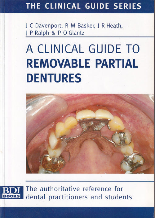 A Clinical Guide to Removable Partial Dentures