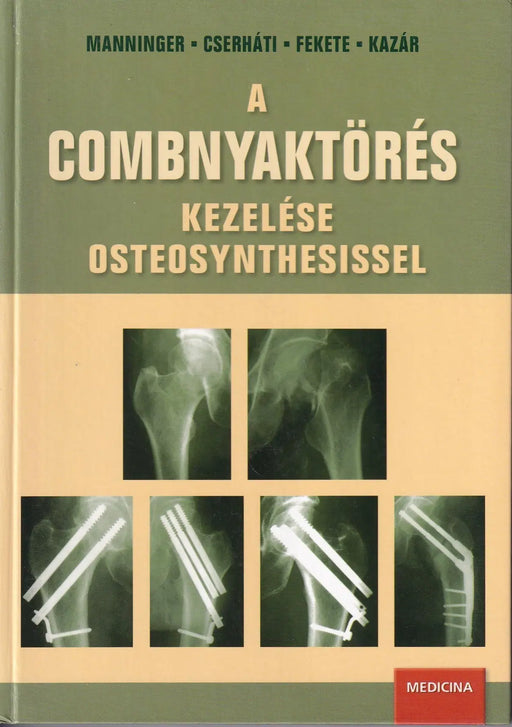 A combnyaktörés kezelése osteosynthesissel - Oskola Antikvárium